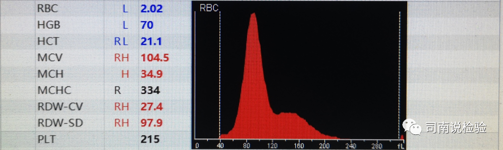 rbc直方图怎么看知识点058：说说红细胞直方图_https://www.jmylbn.com_新闻资讯_第15张