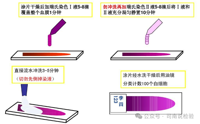 医用染色架 怎么用你问我答145：如何进行染色（瑞氏染色和吉姆萨染色）？_https://www.jmylbn.com_新闻资讯_第4张