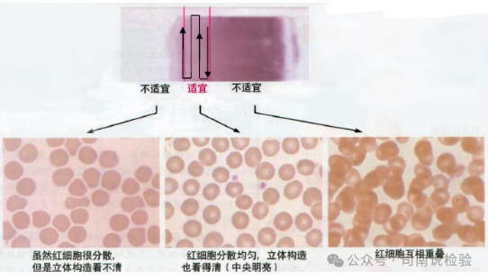 医用染色架 怎么用你问我答145：如何进行染色（瑞氏染色和吉姆萨染色）？_https://www.jmylbn.com_新闻资讯_第8张