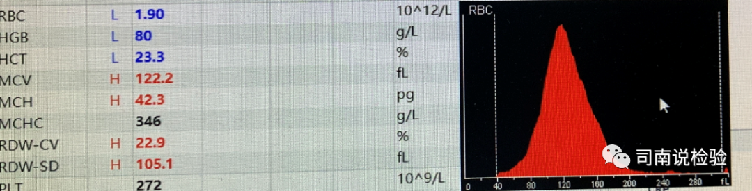 rbc直方图怎么看知识点058：说说红细胞直方图_https://www.jmylbn.com_新闻资讯_第10张