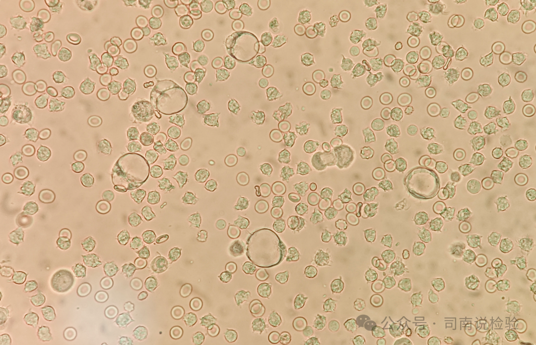 上皮细胞用什么染色知识点202：尿液（尿沉渣）常用的染色方法_https://www.jmylbn.com_新闻资讯_第3张