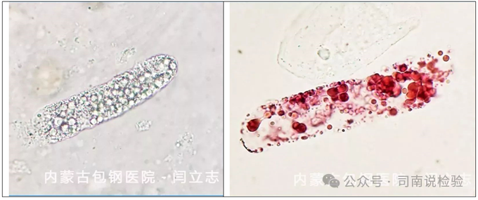 上皮细胞用什么染色知识点202：尿液（尿沉渣）常用的染色方法_https://www.jmylbn.com_新闻资讯_第11张