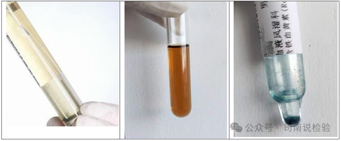 上皮细胞用什么染色知识点202：尿液（尿沉渣）常用的染色方法_https://www.jmylbn.com_新闻资讯_第14张