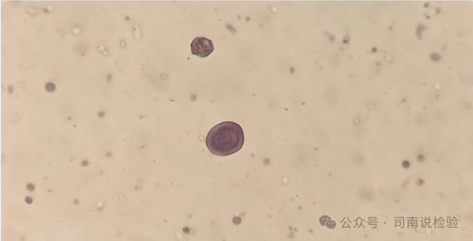 上皮细胞用什么染色知识点202：尿液（尿沉渣）常用的染色方法_https://www.jmylbn.com_新闻资讯_第16张