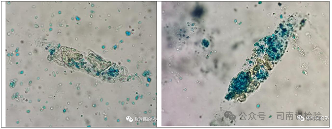 上皮细胞用什么染色知识点202：尿液（尿沉渣）常用的染色方法_https://www.jmylbn.com_新闻资讯_第13张