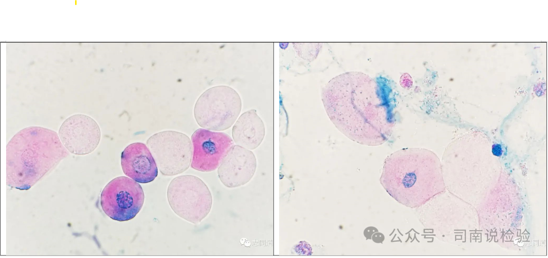 上皮细胞用什么染色知识点202：尿液（尿沉渣）常用的染色方法_https://www.jmylbn.com_新闻资讯_第7张