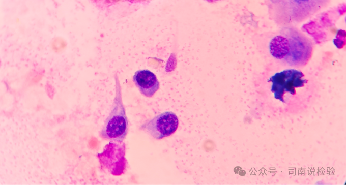 上皮细胞用什么染色知识点202：尿液（尿沉渣）常用的染色方法_https://www.jmylbn.com_新闻资讯_第9张