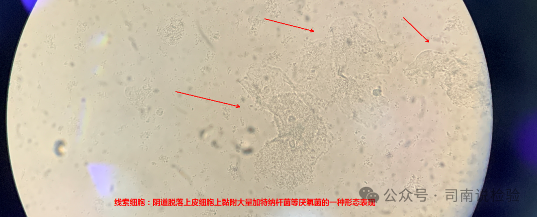 BV唾液酸酶是什么阴道分泌物检查中细菌性阴道炎（BV）时唾液酸苷酶一定阳性吗？_https://www.jmylbn.com_新闻资讯_第3张