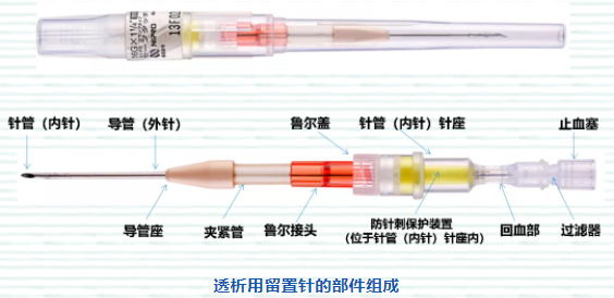 为什么要用动脉留置针透析留置针穿刺建立动静脉内瘘扣眼隧道_https://www.jmylbn.com_新闻资讯_第3张
