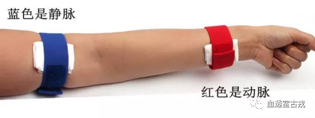 医用弹力绷带怎么取血液透析动静脉内瘘拔针止血，弹力绷带的规范使用_https://www.jmylbn.com_新闻资讯_第2张