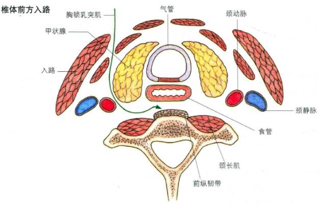 然後沿著胸鎖乳突肌向上下兩端切開頸淺筋膜,再鈍性剝離,把胸鎖乳突肌