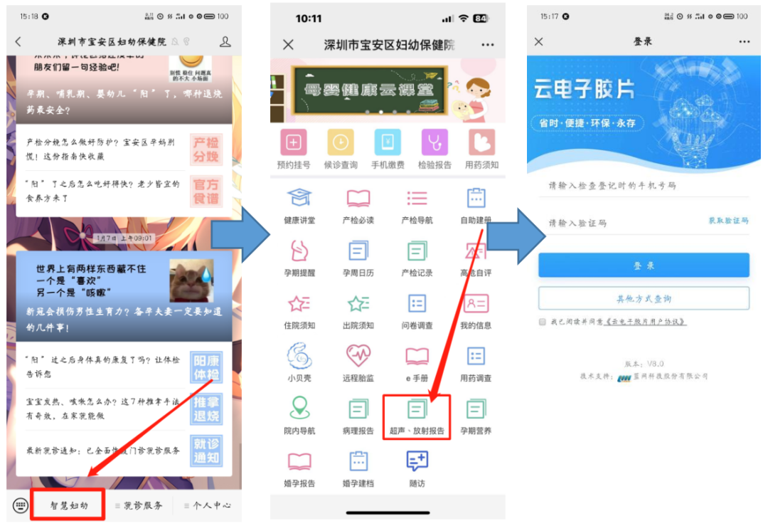 放射科怎么打印【便民】检查报告“无纸化时代”来临！想要纸质报告怎么办？_https://www.jmylbn.com_新闻资讯_第14张