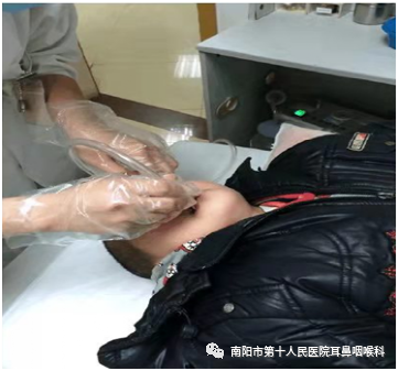 什么是负压操作鼻负压置换疗法的操作流程_https://www.jmylbn.com_新闻资讯_第3张