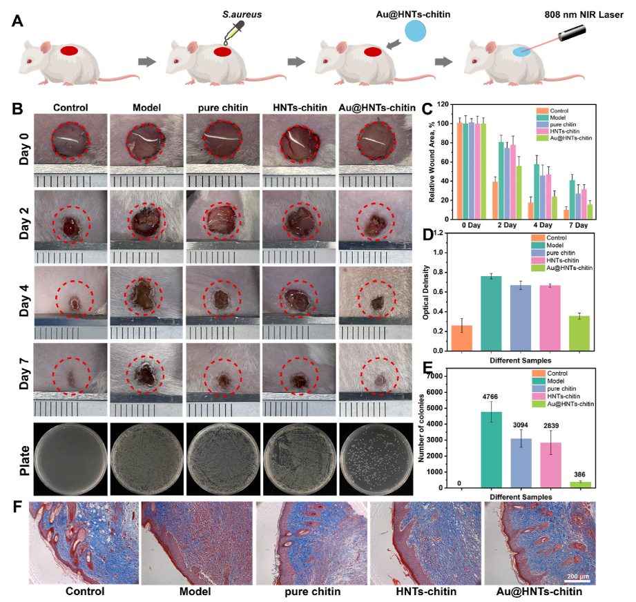 抗菌水凝胶怎么操作新型抗菌复合水凝胶——高效抗菌促进伤口愈合及止血功能_https://www.jmylbn.com_新闻资讯_第3张