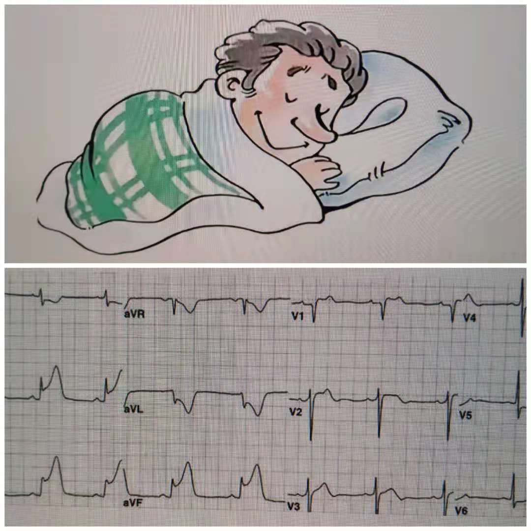 动态心电图自己怎么记录心电图已经成为常规检查，那么动态心电图，你了解吗？_https://www.jmylbn.com_新闻资讯_第4张