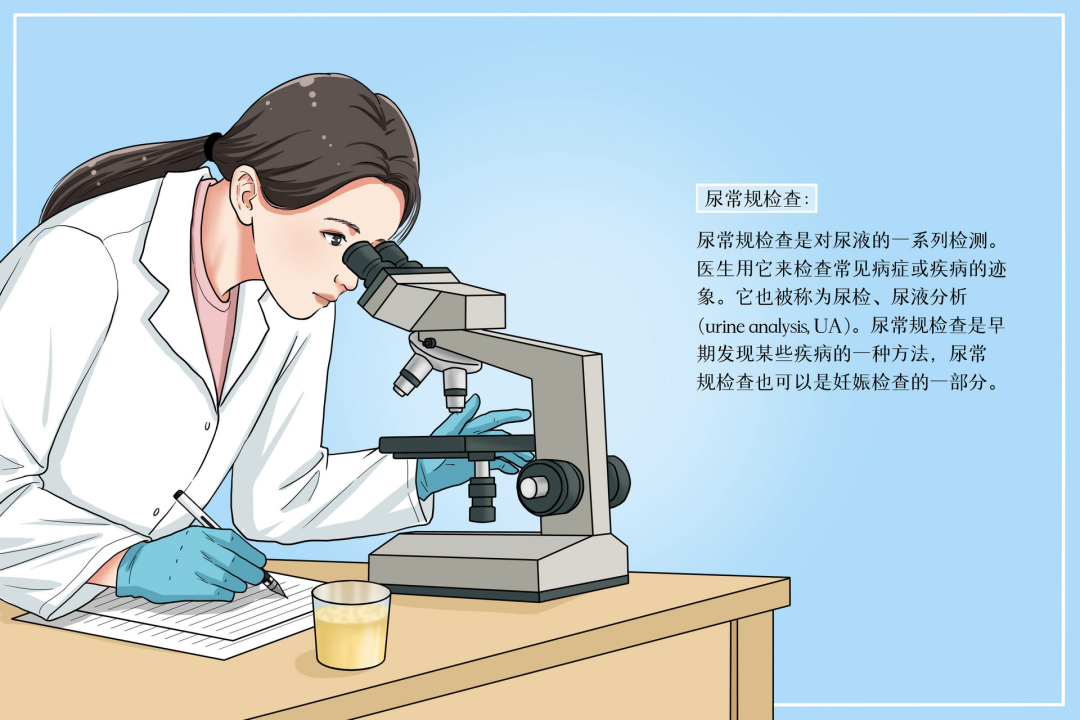 poct什么意思三大常规检查之一的尿常规，检查单你看的懂吗？了解一下每个项目代表的意思吧！_https://www.jmylbn.com_新闻资讯_第2张