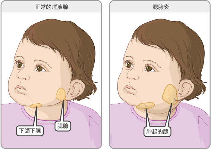 试管知识 | 悄悄吞噬你生育力的"怪物"！