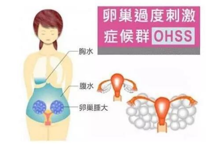 AMH值低于这个范围，提示你可能“卵巢早衰”了！