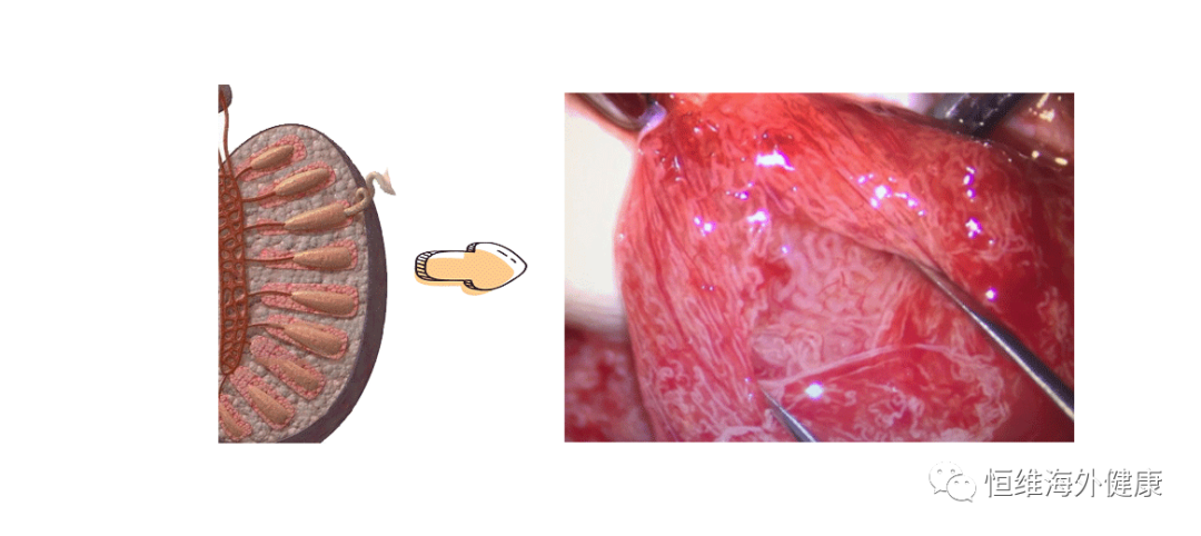 禁欲 ≠ 酿酒,「养精千日」并不能提升精子质量！！！