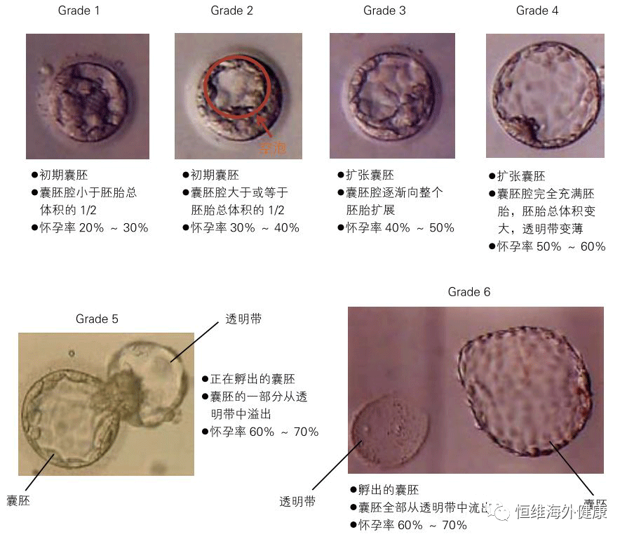 试管科普 | 做试管婴儿，要多少颗胚胎才能养成一颗囊胚？