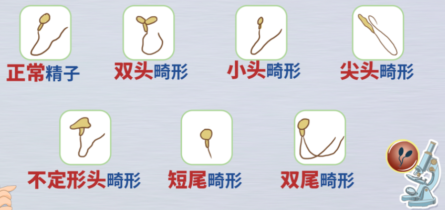试管知识 | 精子畸形率高会导致胎儿畸形吗?