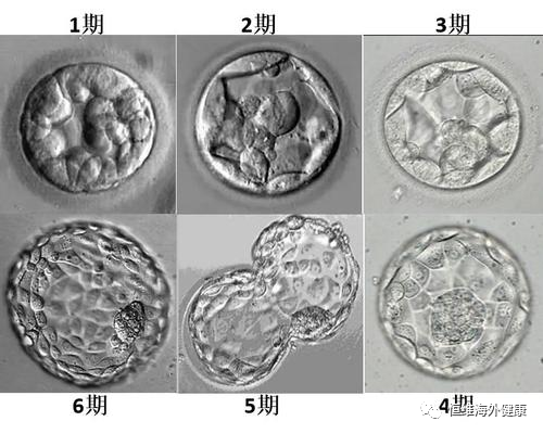 分钟带你了解胚胎级别，科学评估试管婴儿成功率！"