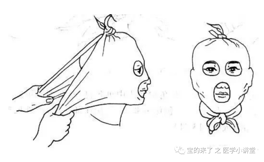 医用纱布绷带怎么绑急救知识 ｜ 绷带及三角巾包扎法_https://www.jmylbn.com_新闻资讯_第15张