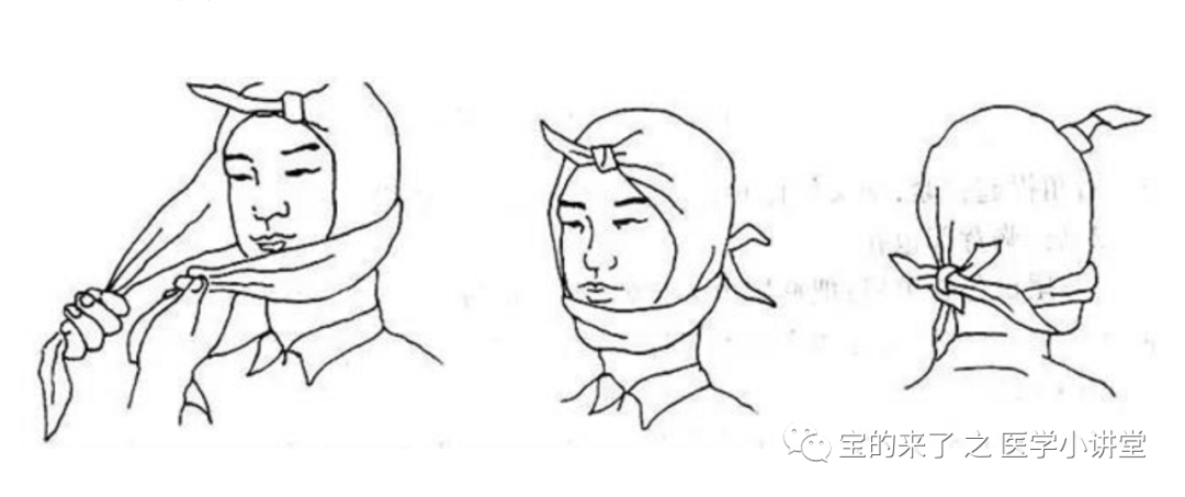医用纱布绷带怎么绑急救知识 ｜ 绷带及三角巾包扎法_https://www.jmylbn.com_新闻资讯_第13张