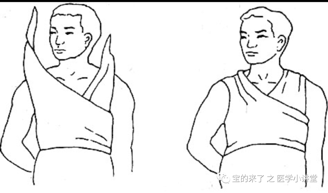 医用纱布绷带怎么绑急救知识 ｜ 绷带及三角巾包扎法_https://www.jmylbn.com_新闻资讯_第23张