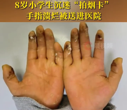 关于“烟卡”游戏致全体家长的一封信：风靡中小学生圈的这款游戏，仍在侵蚀孩子们健康成长