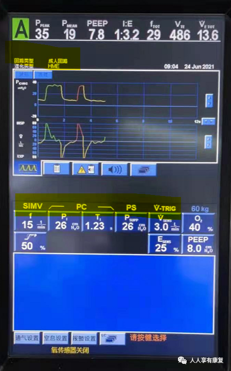 为什么成人呼吸机用容控菜鸟康复医师学习呼吸机_https://www.jmylbn.com_新闻资讯_第6张