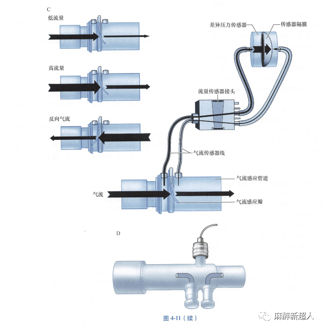 为什么用麻醉呼吸回路规培笔记：麻醉机呼吸回路_https://www.jmylbn.com_新闻资讯_第4张