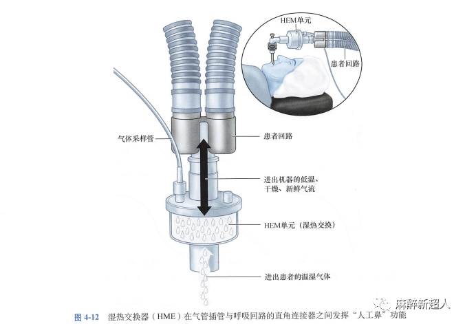 为什么用麻醉呼吸回路规培笔记：麻醉机呼吸回路_https://www.jmylbn.com_新闻资讯_第5张