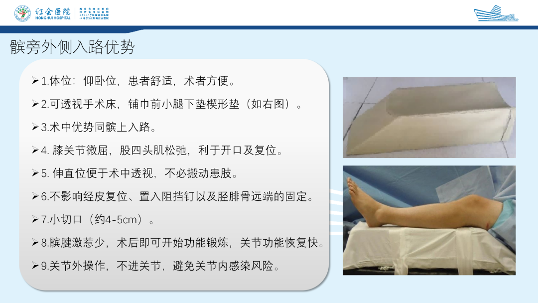 髌旁外侧入路胫骨髓内钉的临床应用