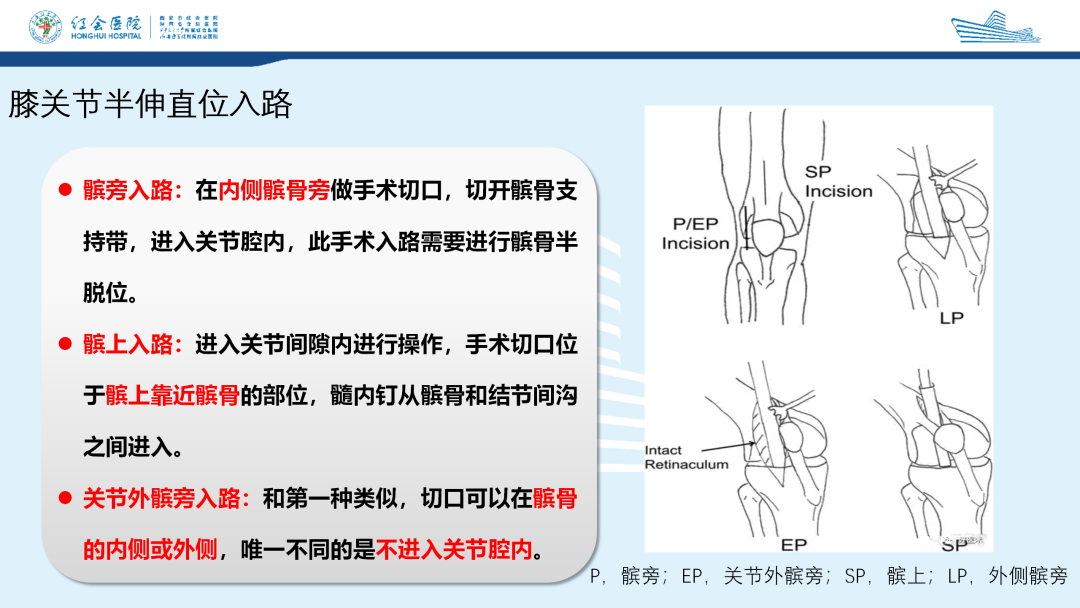 髌旁外侧入路胫骨髓内钉的临床应用