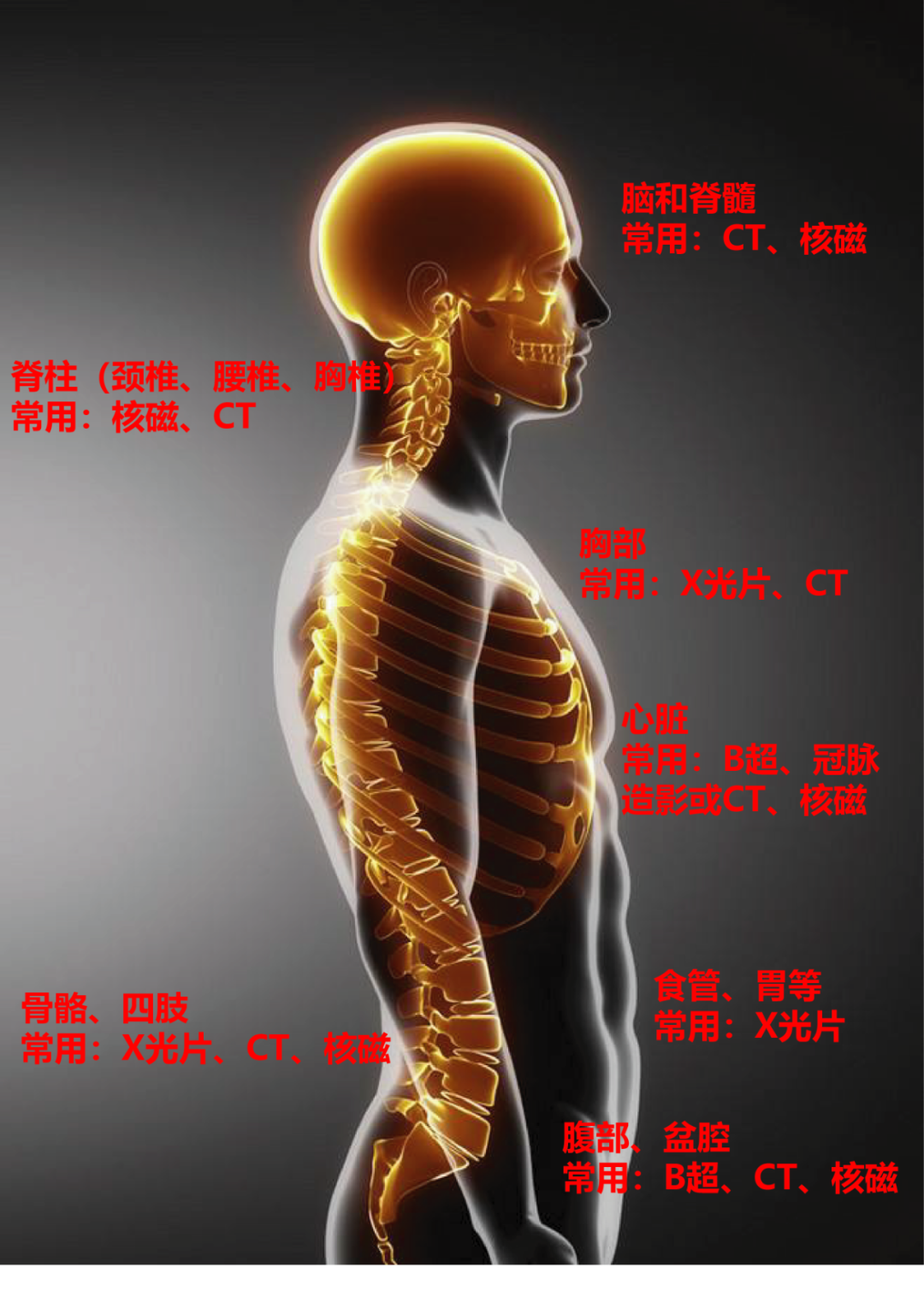 dr在彩超什么意思一文搞懂X线、CT、MR、彩超检查的区别_https://www.jmylbn.com_新闻资讯_第17张