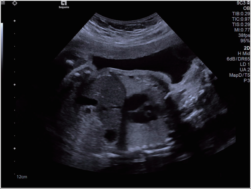 dr在彩超什么意思一文搞懂X线、CT、MR、彩超检查的区别_https://www.jmylbn.com_新闻资讯_第3张