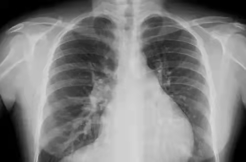 dr在彩超什么意思一文搞懂X线、CT、MR、彩超检查的区别_https://www.jmylbn.com_新闻资讯_第10张