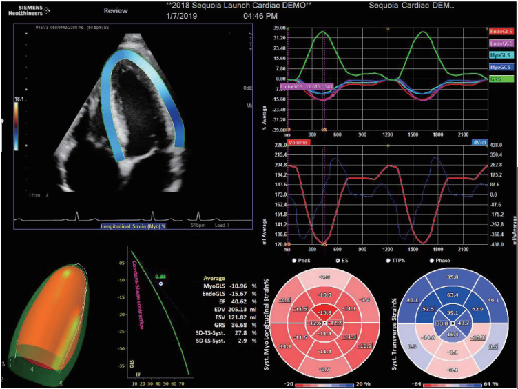 dr在彩超什么意思一文搞懂X线、CT、MR、彩超检查的区别_https://www.jmylbn.com_新闻资讯_第4张