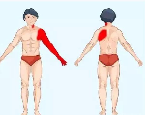 古法经络|身体的语言：疼痛对照表！