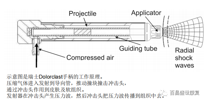 冲击波治疗是什么原理放散状体外冲击波的治疗原理_https://www.jmylbn.com_新闻资讯_第10张