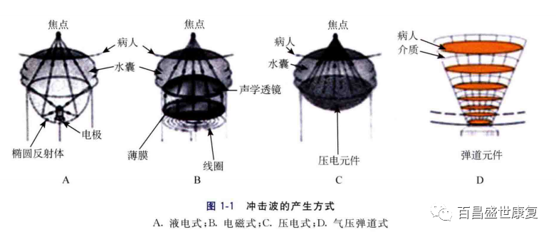 冲击波治疗是什么原理放散状体外冲击波的治疗原理_https://www.jmylbn.com_新闻资讯_第7张