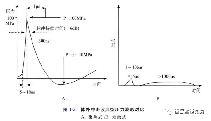 冲击波治疗是什么原理放散状体外冲击波的治疗原理_https://www.jmylbn.com_新闻资讯_第2张
