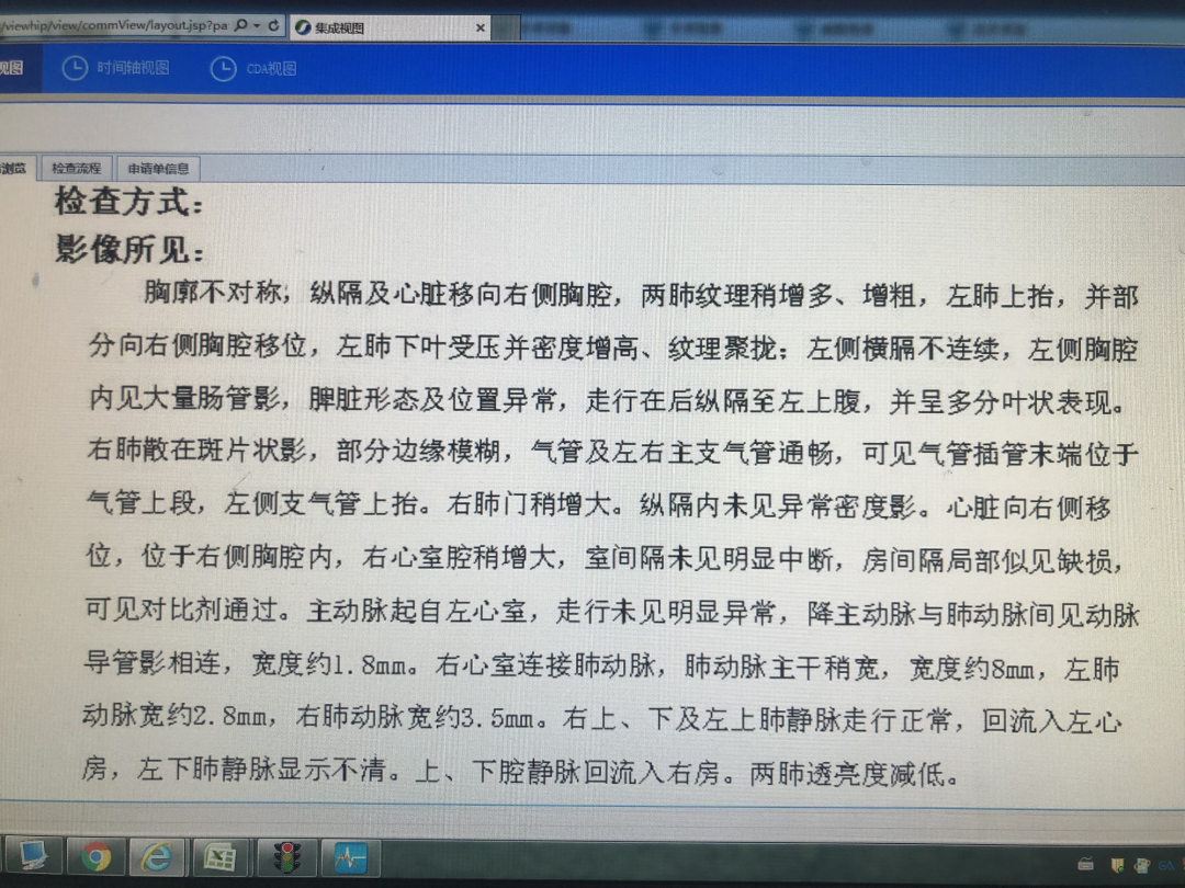 什么是Acdh【儿科麻醉】先天性膈疝CDH_https://www.jmylbn.com_新闻资讯_第3张