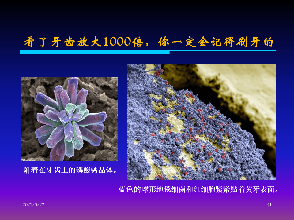 如何控制液壓系統清潔度（轉自液壓那些事）的圖41