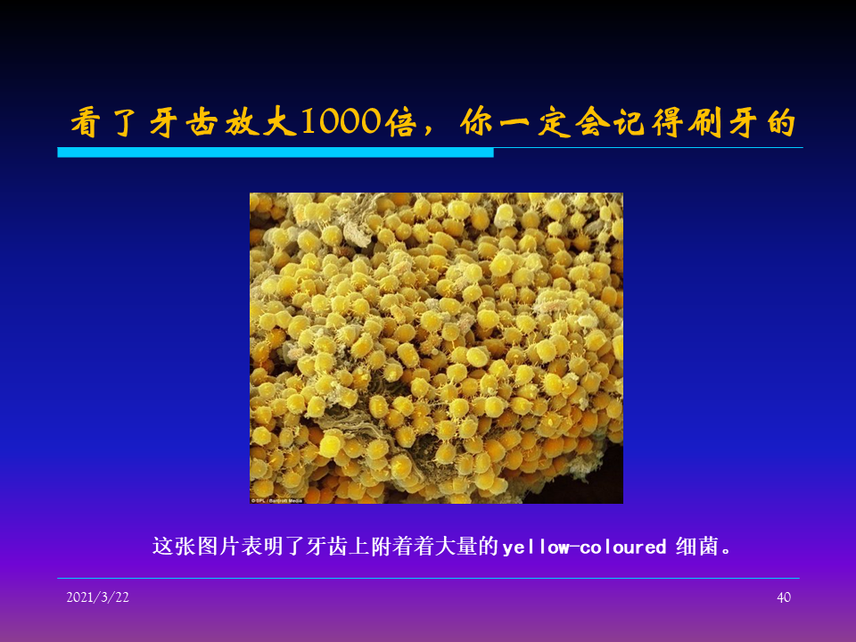 如何控制液壓系統清潔度（轉自液壓那些事）的圖40