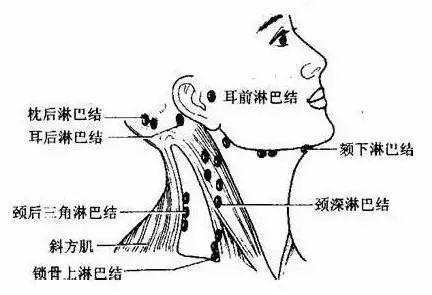 脖子淋巴结图片位置图片