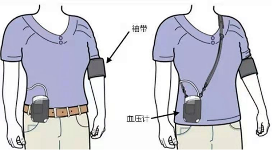 dms动态血压怎么使用【健康科普】“动态”虽小，大有“作为”——24小时动态心电图、动态血压检测_https://www.jmylbn.com_新闻资讯_第11张