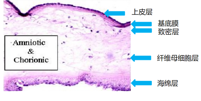手术膜怎么用胎盘内的一层膜，竟在眼科手术中派上大用场！_https://www.jmylbn.com_新闻资讯_第9张