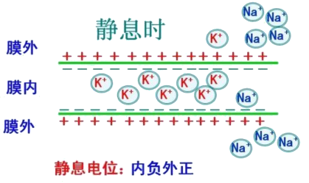 为什么要用推注泵临床基础知识系列（1）-高钾血症的碎碎念_https://www.jmylbn.com_新闻资讯_第3张